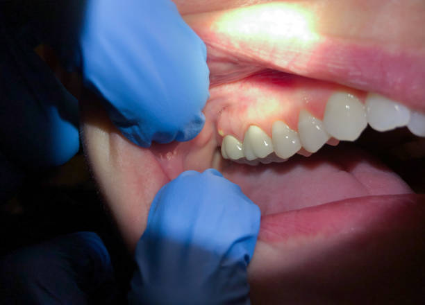 Best Emergency Gum Pain Relief  in Columbia, MS